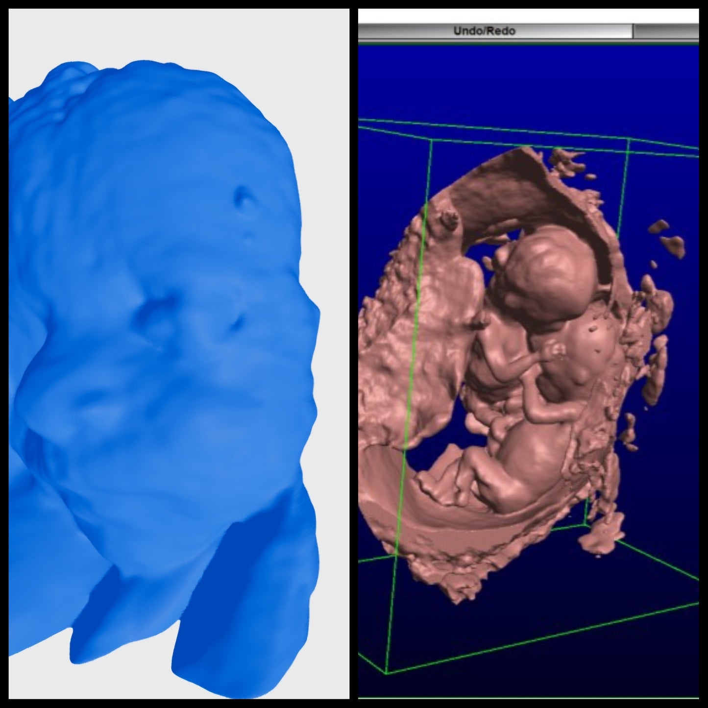 3D figura a magzatról